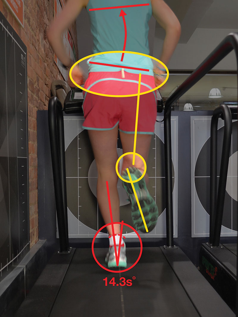 Gait analysis