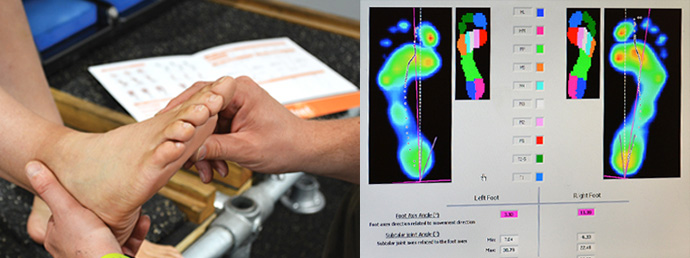 Video gait analysis