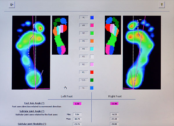 running foot scan