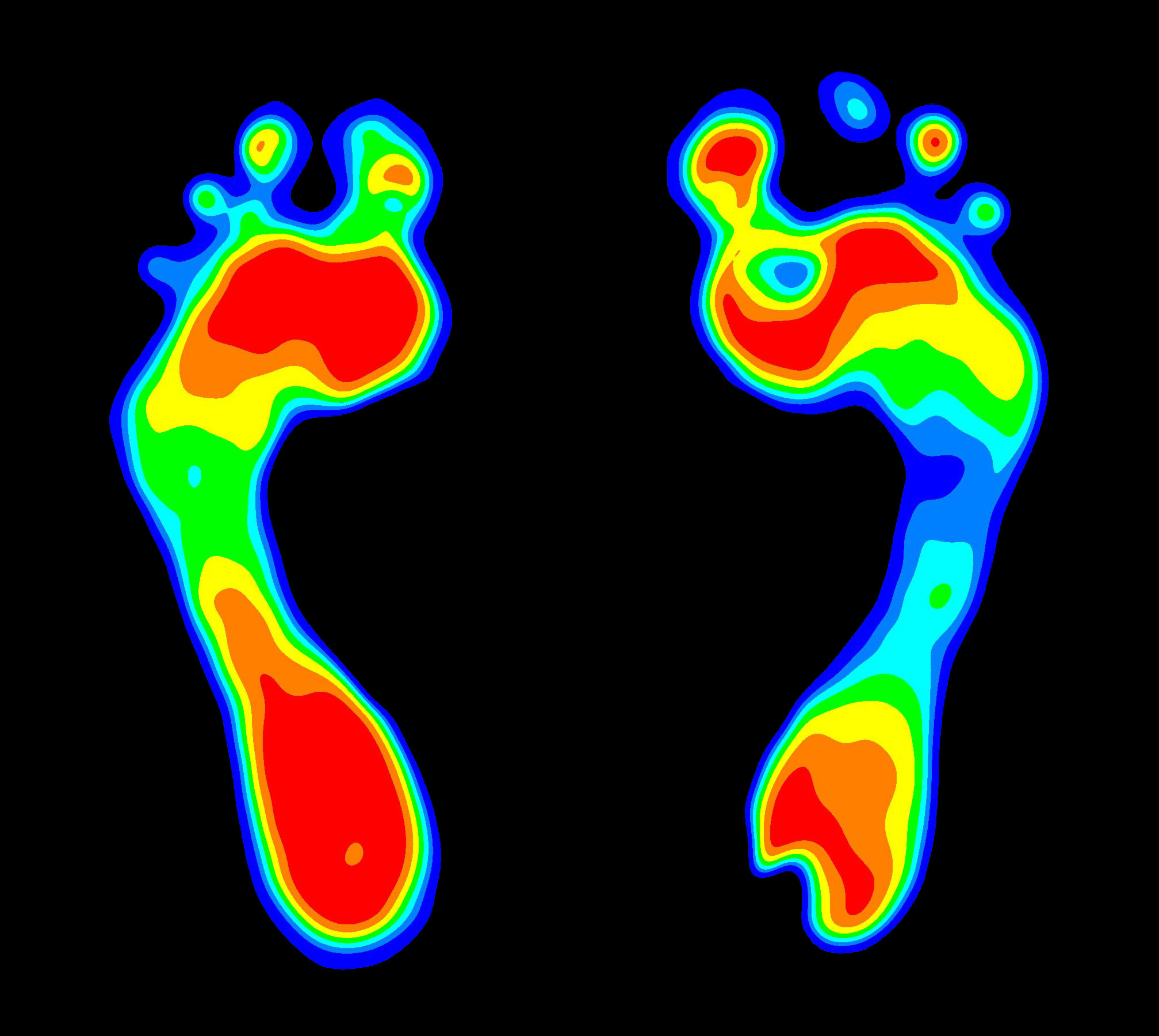 Foot Pressure Scan